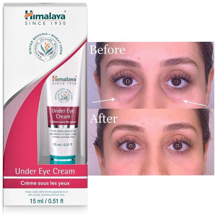 Himalaya under eye cream