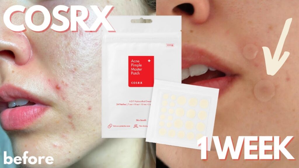 A package of 24 CosRx Acne Pimple Master Patches displayed on a clean white background.